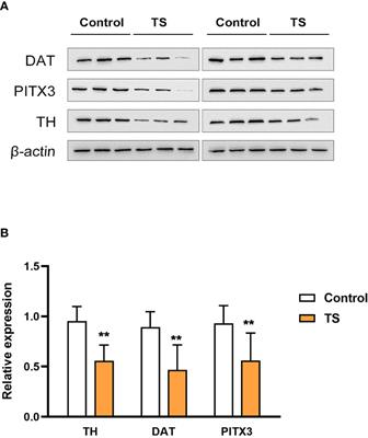 The inflammatory injury in the striatal microglia-dopaminergic-neuron crosstalk involved in Tourette syndrome development